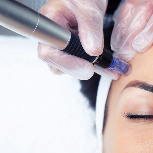 What Is Microneedling?