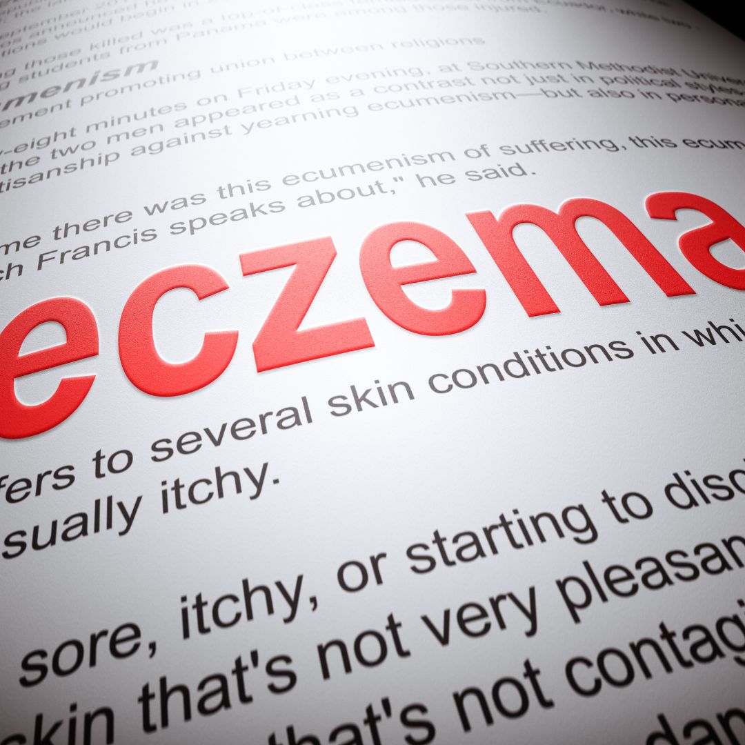 Eczema: Causes and Treatment
