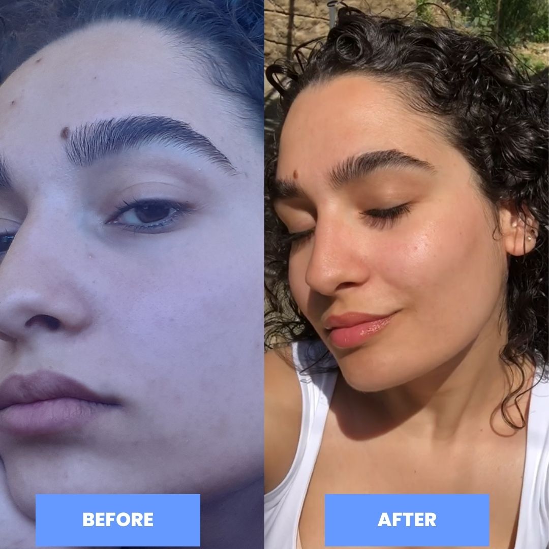 before and after using moisturizer and vitamin c serum