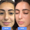 Load image into Gallery viewer, Before and after skincare results after using the glow up bundle